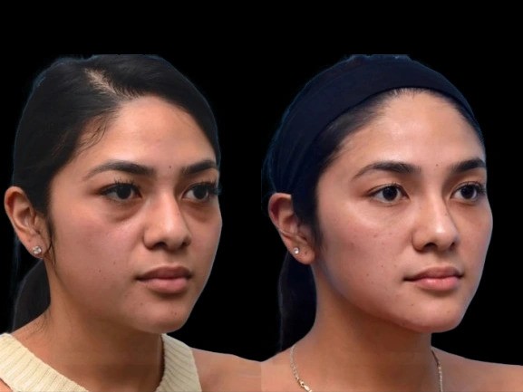 How the Best Doctors in Dubai Identify the Root Cause of Dark Circles