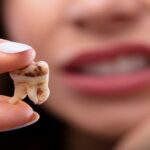 Dental Care Guide for Retained Tooth Roots