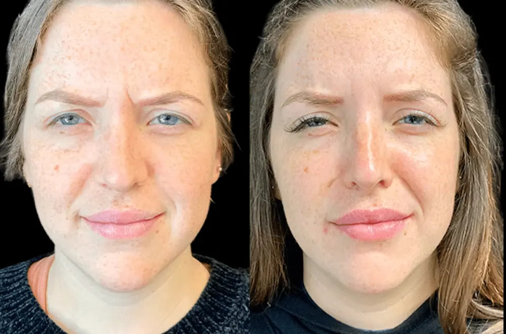 Best Doctors in Dubai for Botox: Latest Trends and Innovations