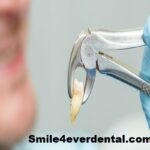 Relieve Puffiness After Tooth Removal Quickly