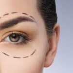 Upper blephroplasty in jeddah, lower eyelid surgery in jeddah, otoplasty in jeddah, abdominoplasty in jeddah,