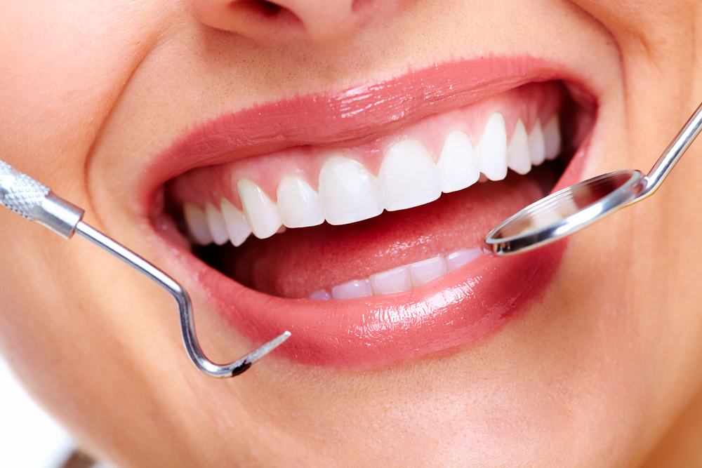 Dental Tooth Filling Dubai with Pain-Free Treatment