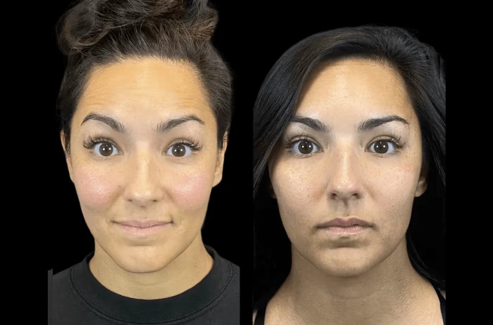 How the Best Aesthetic Clinic in Dubai Ensures Safe and Long-Lasting Results