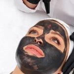 Carbon laser treatment